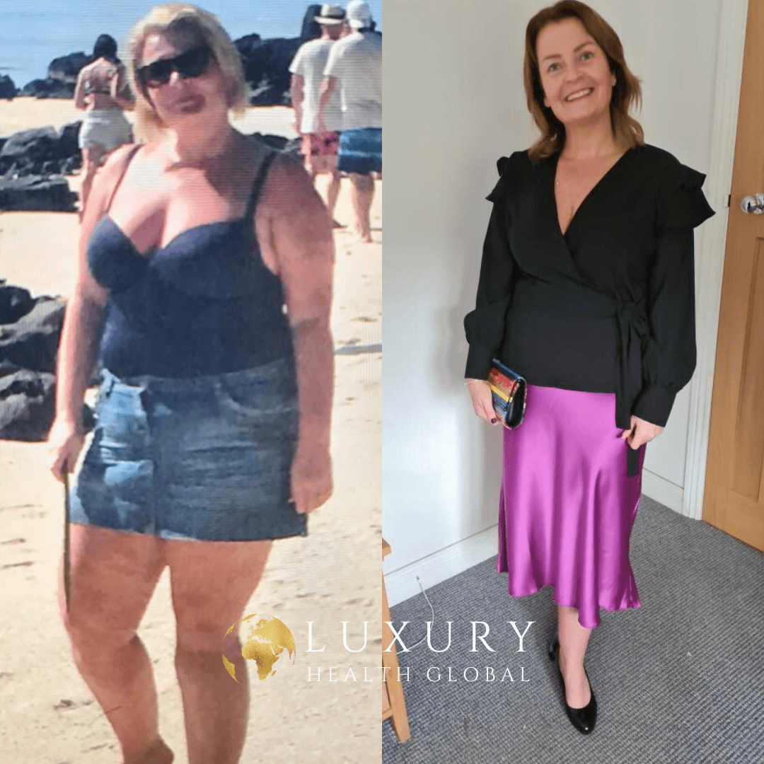 Obesity Surgery - 40 kg Kayıp Öncesi
