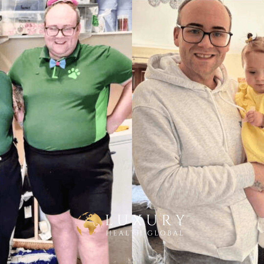 Obesity Surgery - 63.5 kg Kayıp Öncesi