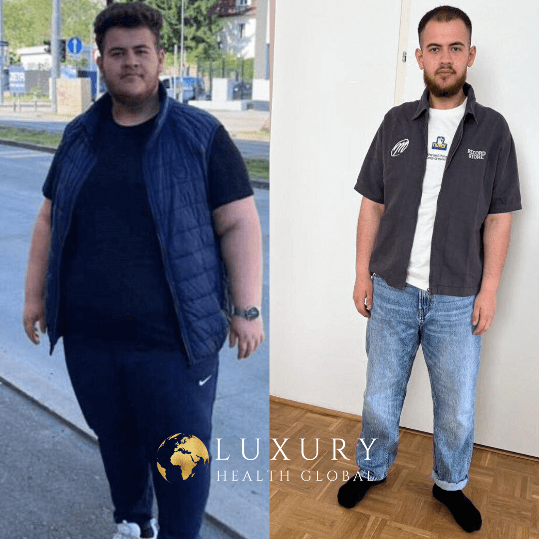 Obezite Cerrahisi - 86.8 kg Kayıp Öncesi
