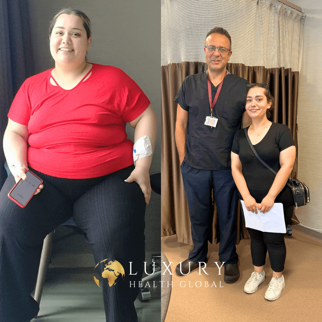 Obezite Cerrahisi - 1 Yıllık Sonuç, 42 kg Kayıp Öncesi