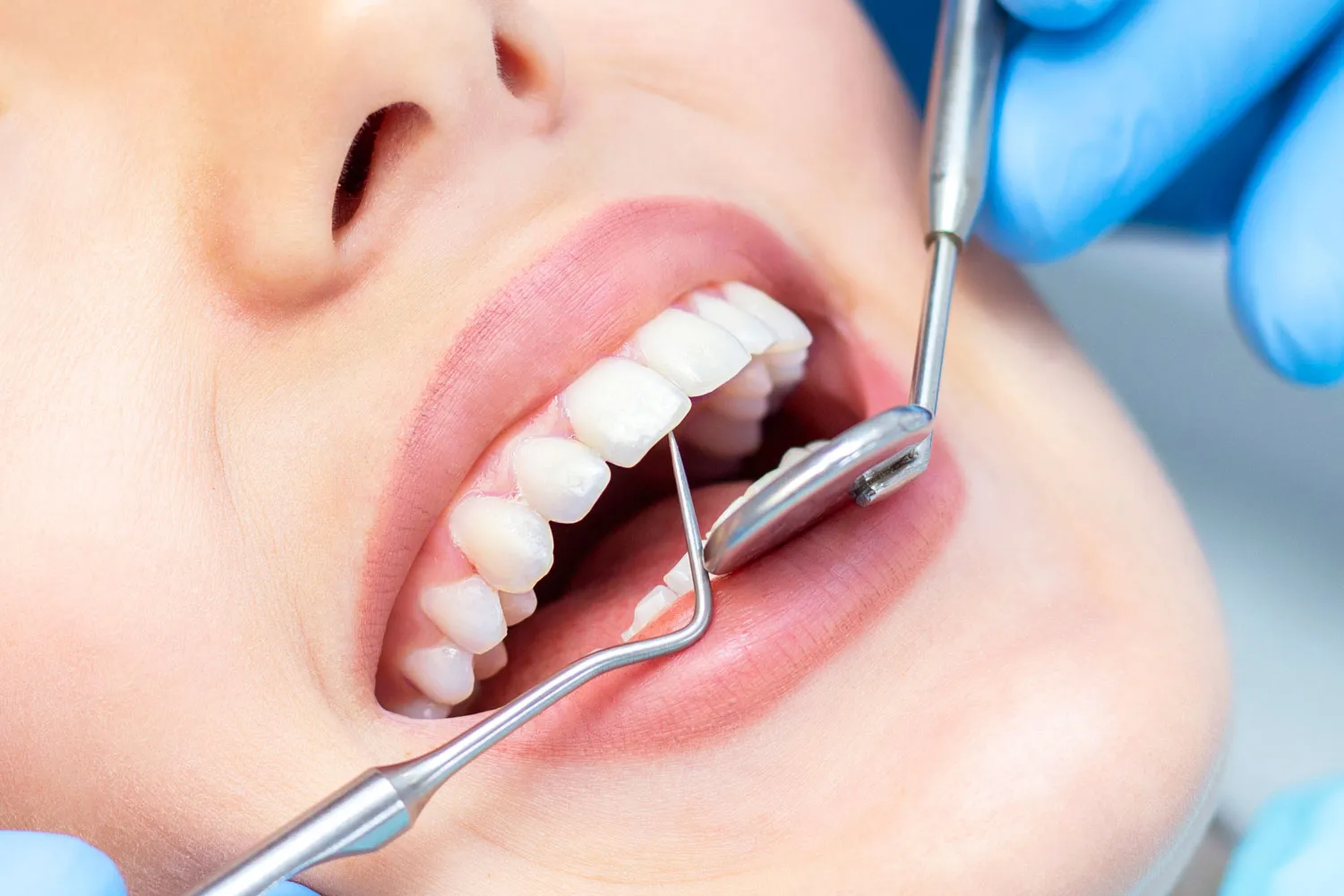 Dental